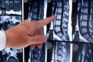 možné komplikace snímek